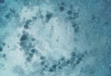 Dlaczego wycieraczki Rozmazują wodę na szybie?