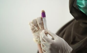 Ile trwa badanie komputerowe samochodu?